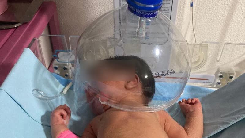 ¡Solo en México!: usan botella de plástico para oxigenar a recién nacido en IMSS Tabasco 