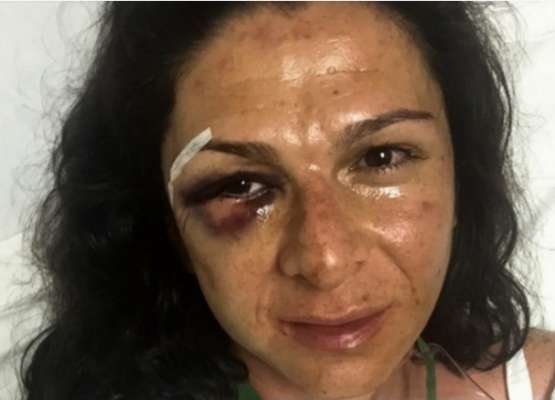 (Vídeo) Difunden vídeo de la agresión a Ana Gabriela Guevara 