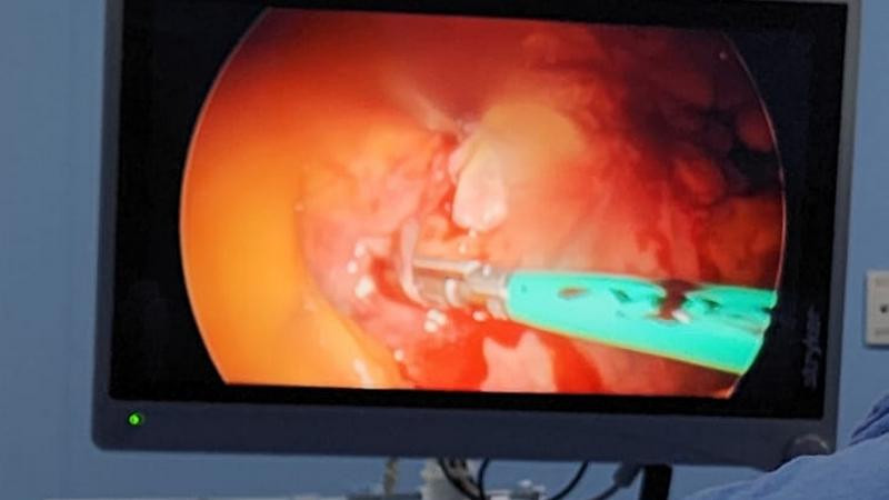 Reconoce ISSSTE a pacientes sobrevivientes de cáncer 