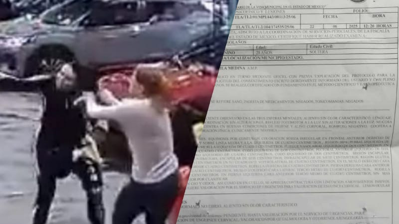 Mujer exige justicia tras ser brutalmente atacada por dos mujeres en el Estado de México 