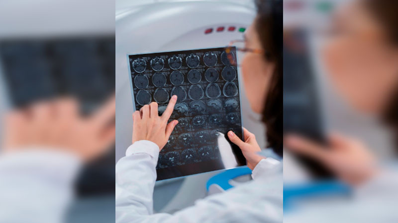 Científicos de UNAM Querétaro implementan estimulación magnética para tratar adicciones, ansiedad, depresión y accidentes cerebrovasculares  