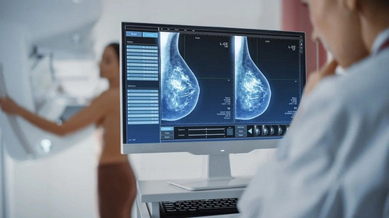 En lo que va del 2025, han fallecido 90 mujeres por cáncer de mama en Querétaro; prevención es indispensable