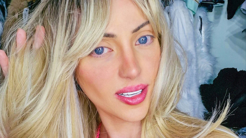 Muere la ‘Barbie humana’ brasileña a los 31 años; investigan su fallecimiento como “muerte sospechosa” 