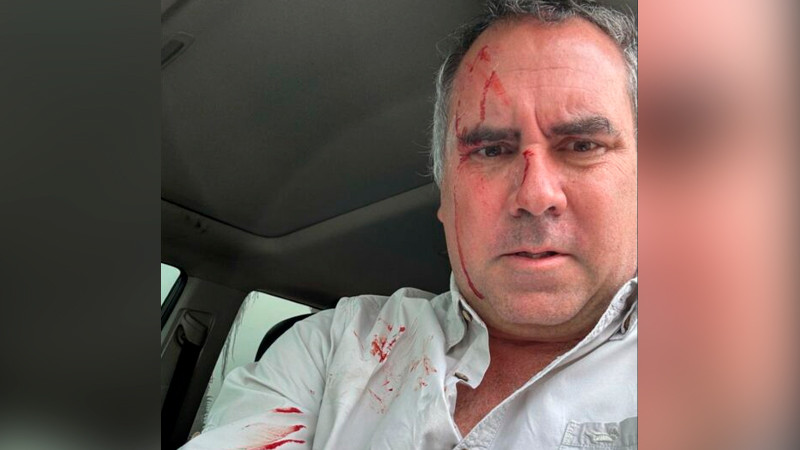 Atentan contra Rafael Belgúnde, candidato presidencial peruano 