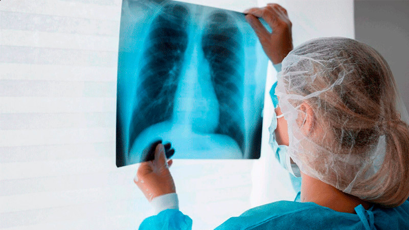 Detectan dos casos de tuberculosis en el mayor centro de retención de migrantes de EEUU 