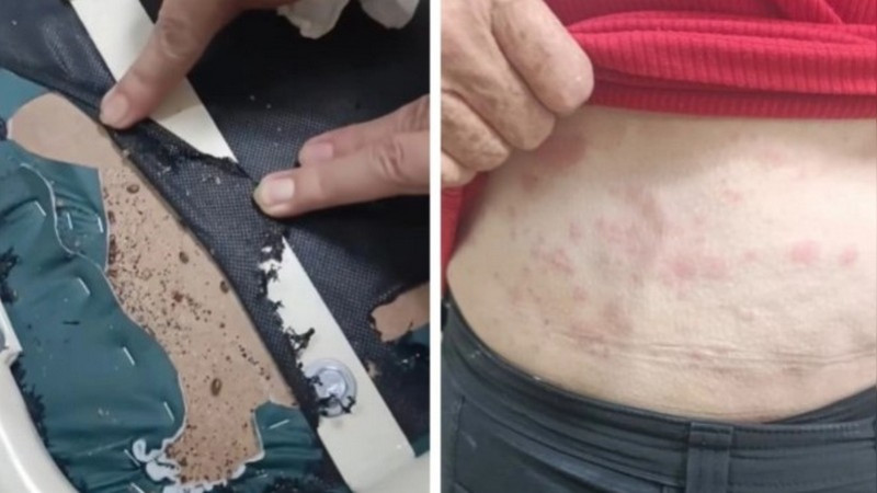 Reportan presunta plaga de chinches en hospital del IMSS en Guadalajara 
