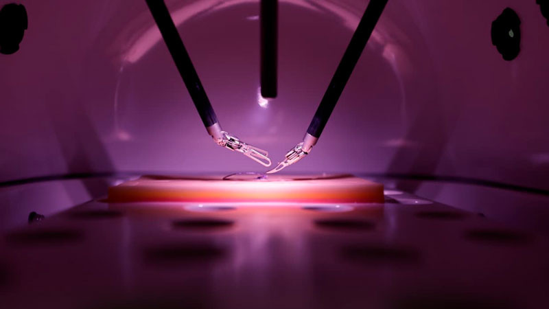 Beneficia Hospital Regional del ISSSTE en Torreón a una paciente con tumor renal mediante cirugía de robot Da Vinci 