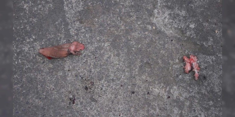 Tangancícuaro: Quiso aventar un explosivo y le detonó en la mano  - Foto 1 