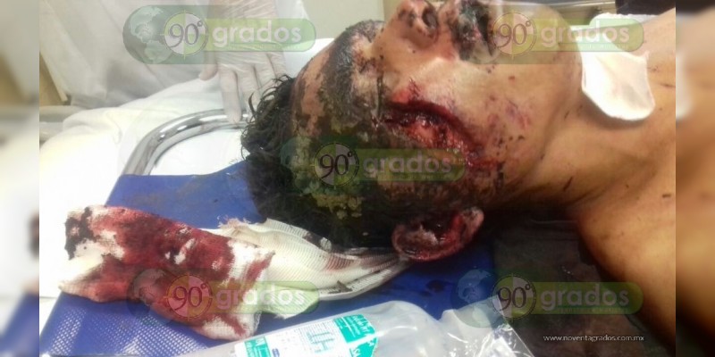 Moribundo hallan a joven que fue salvajemente golpeado  en Apatzingán  - Foto 1 