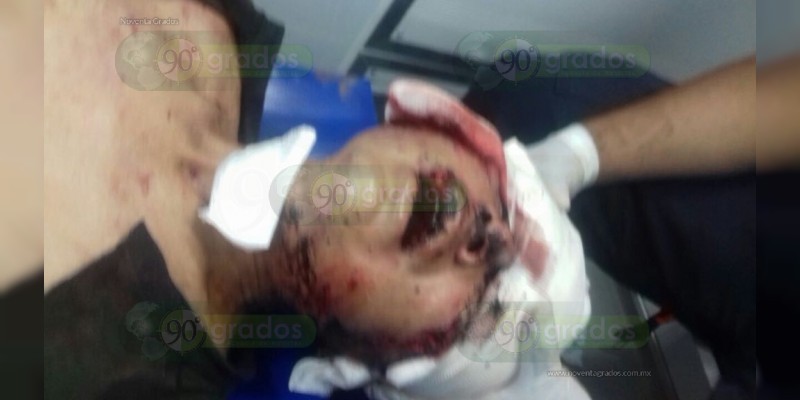 Moribundo hallan a joven que fue salvajemente golpeado  en Apatzingán  - Foto 2 