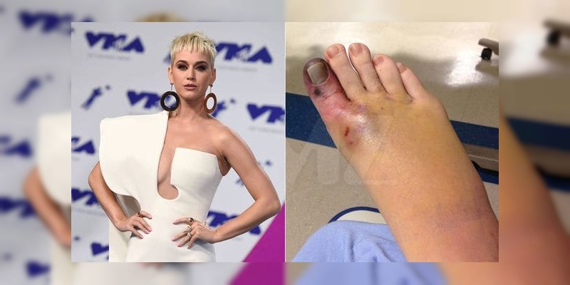 Demandan a Katy Perry  por millonaria cifra de dinero, por su culpa asistente pierde un dedo del pie  - Foto 0 