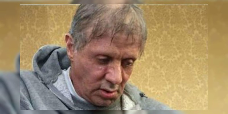 Filtran fotografía de Sylvester Stallone con posibles signos de cáncer  