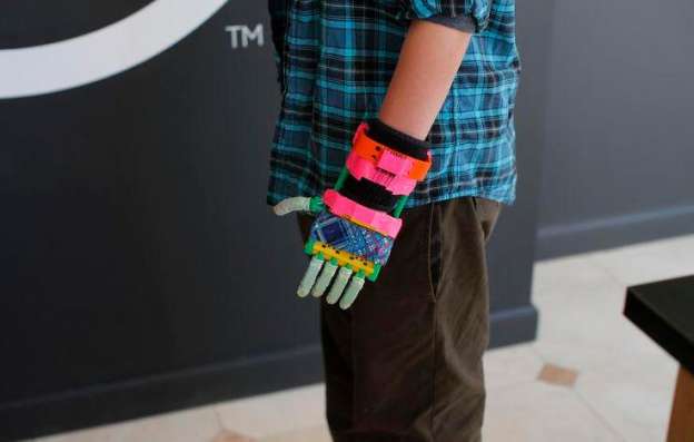 Menor francés recibe prótesis fabricada con impresora 3D 