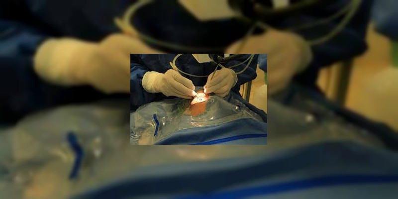 Al menos treinta casos de retinosis pigmentaria han sido diagnosticados en derechohabientes michoacanos 