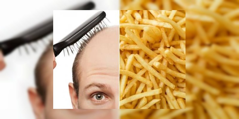 Las papas de McDonald's podrían ser la cura a la calvicie  