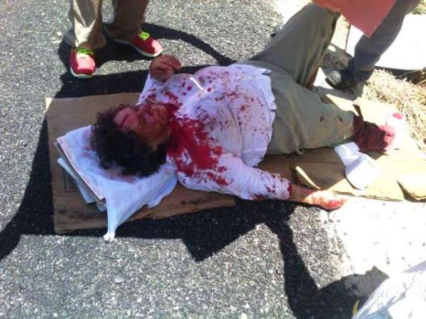 Lesionados dos adultos mayores tras volcadura sobre la Zihuatanejo - Lázaro Cárdenas - Foto 1 