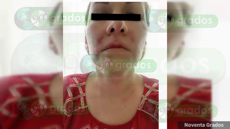 Mujer es brutalmente golpeada por su ex pareja sentimental en Jacona, Michoacán - Foto 2 