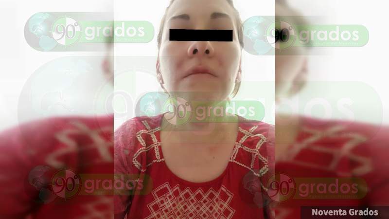 Mujer es brutalmente golpeada por su ex pareja sentimental en Jacona, Michoacán - Foto 3 