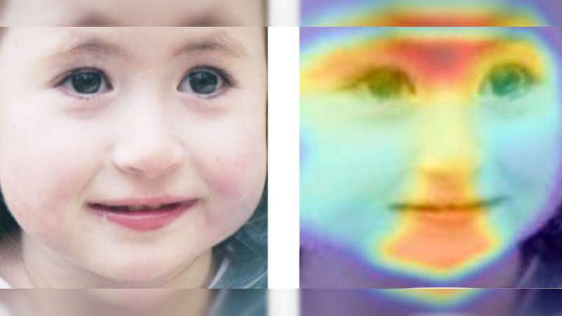 Inteligencia Artificial puede diagnosticar desórdenes raros usando solo una fotografía de la cara - Foto 0 