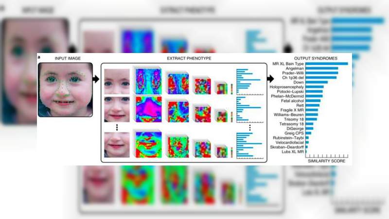 Inteligencia Artificial puede diagnosticar desórdenes raros usando solo una fotografía de la cara - Foto 1 