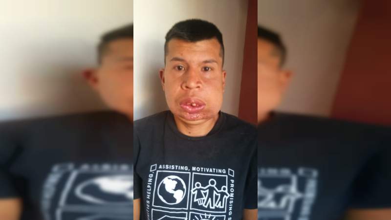 Familia de escasos recursos clama por apoyo para tratamiento de Luis Ángel - Foto 1 