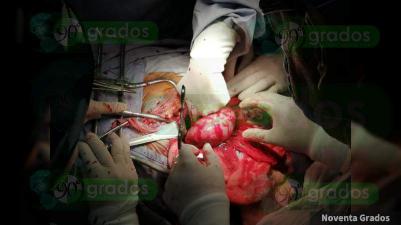 Realizan el transplante renal no. 90 en el Hospital General de Uruapan - Foto 2 