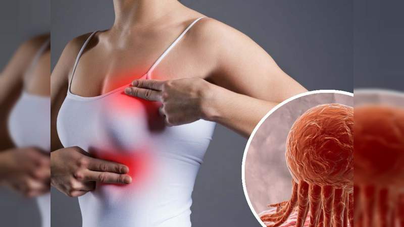 Diseñan vacuna para curar el cáncer de mama 