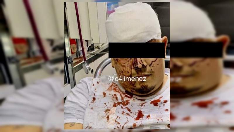 Colombianos se estrellan durante persecución en la Ciudad de México: Son los atropellados de Lindavista  - Foto 1 