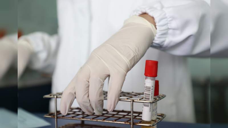 Suspende SSM, clínica particular en Purépero por contagio de hepatitis C 