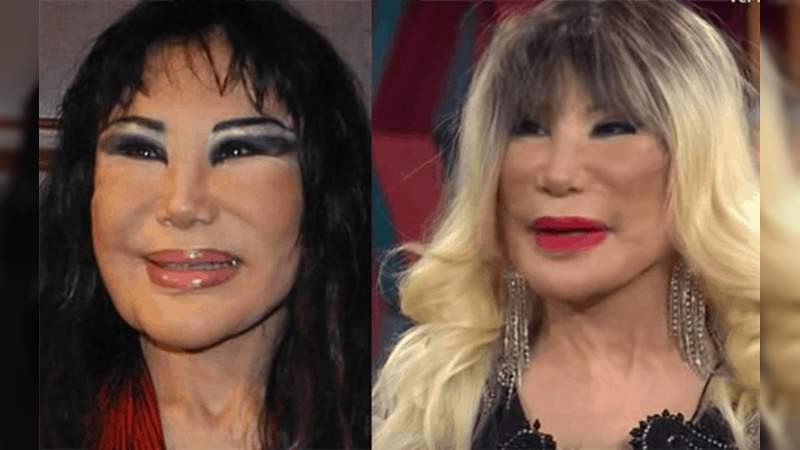 Lyn May se opera y presume su nuevo rostro , aunque no fue un gran cambio. 